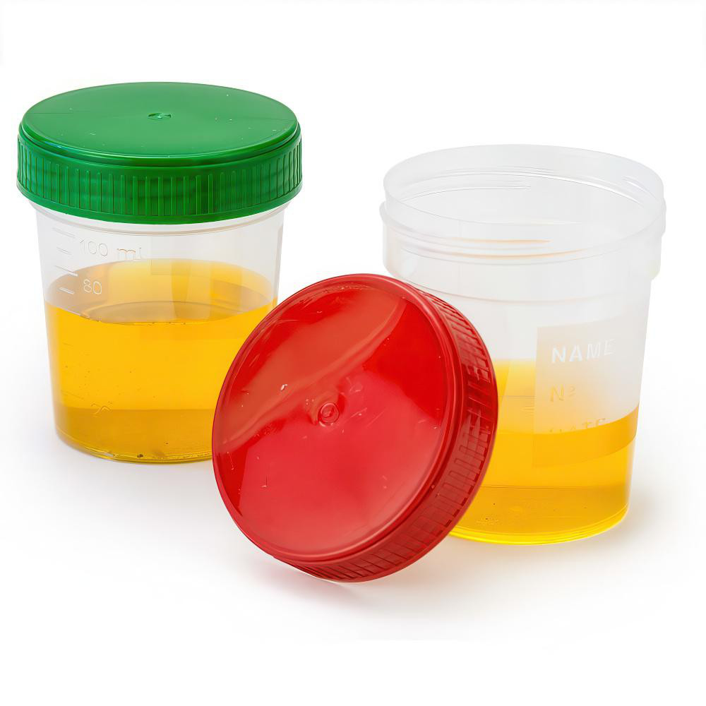 Globe Scientific - Specimen & Sample Containers: Type: Specimen ...