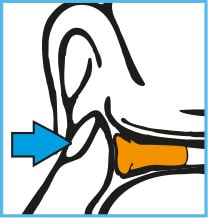 setp 3 insert